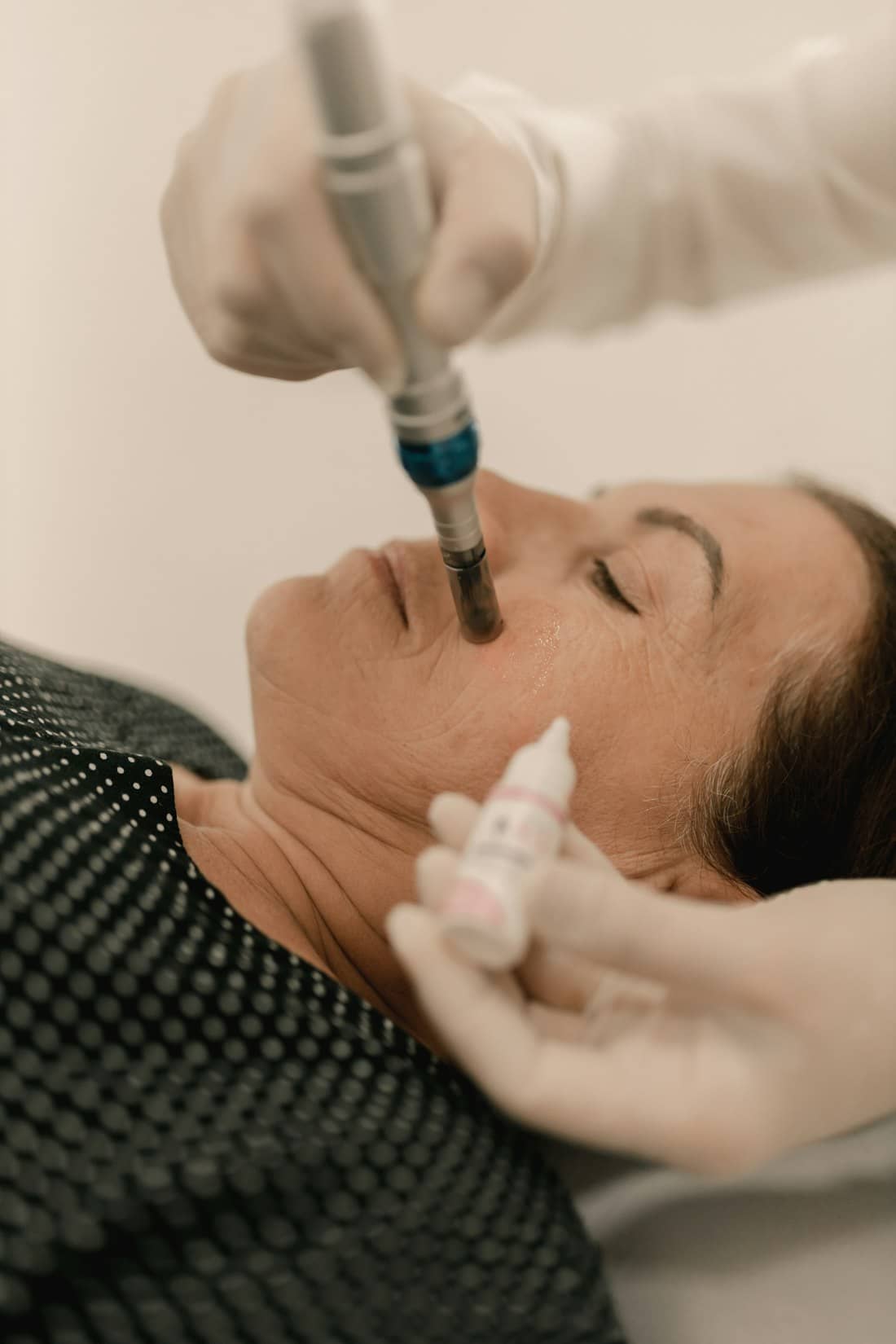A microneedling pen guided across a client's cheek by a practitioner in white gloves